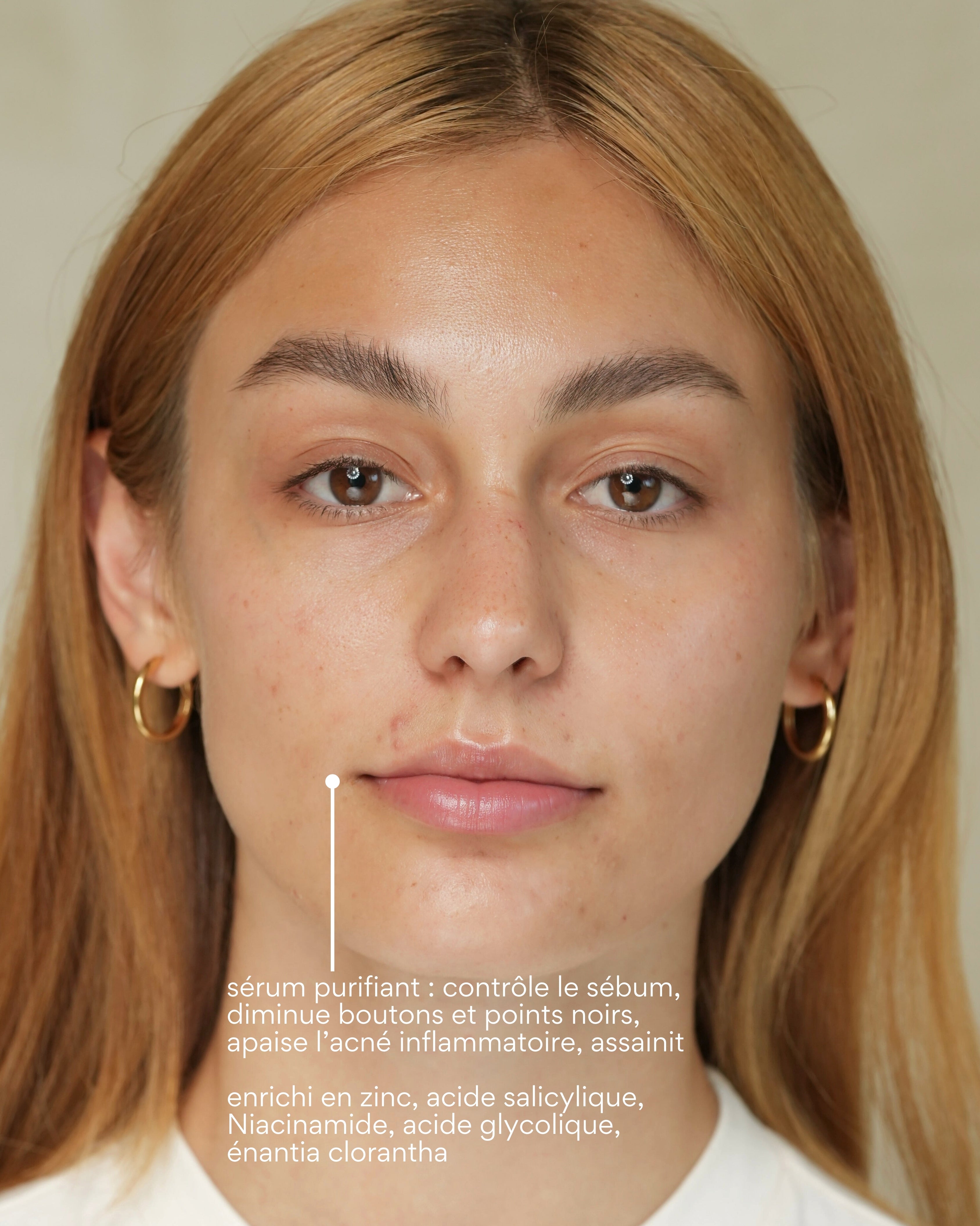 Coffret Anti-Imperfections