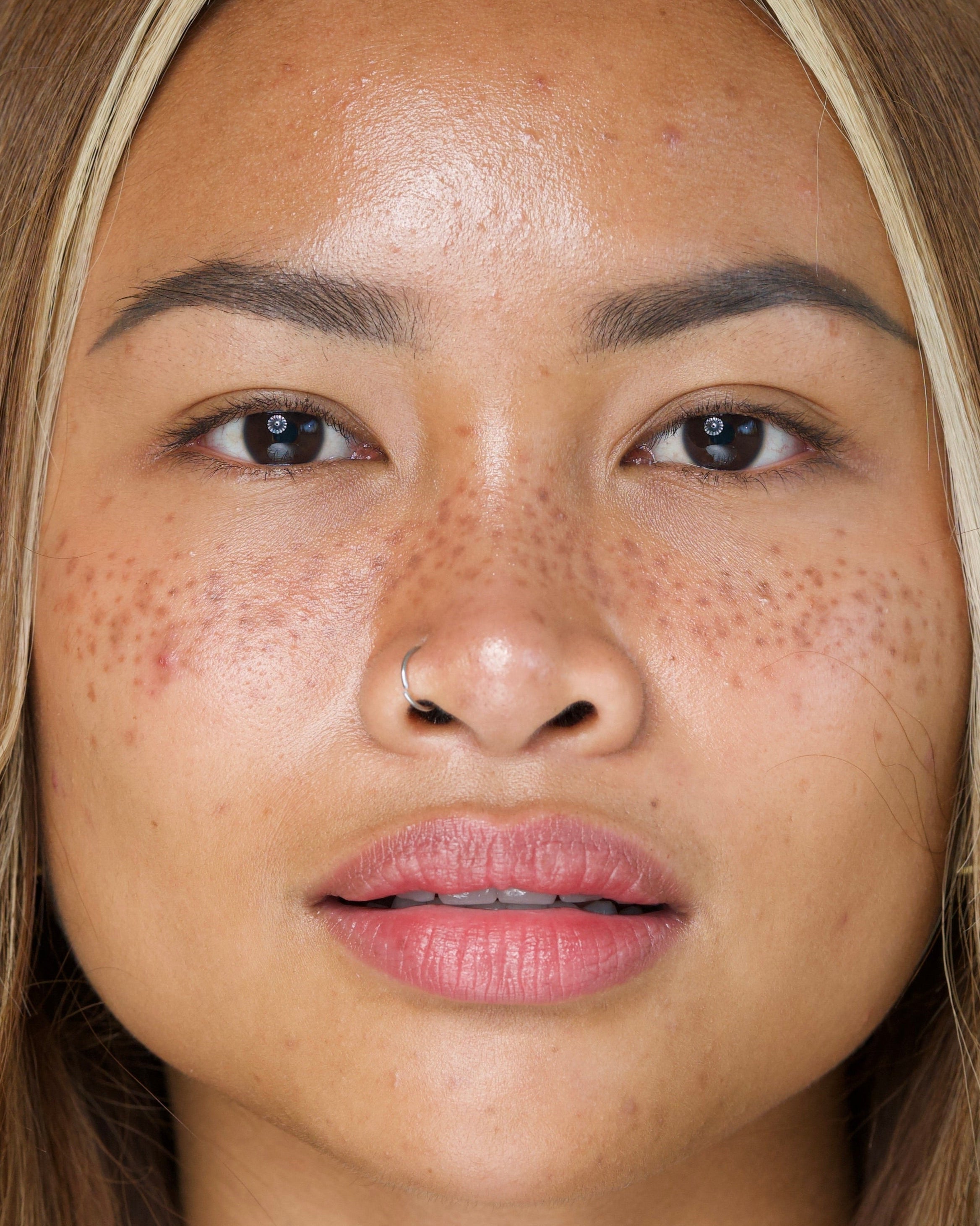 SET ANTI-IMPERFECTIONS •acné, pores et sébum