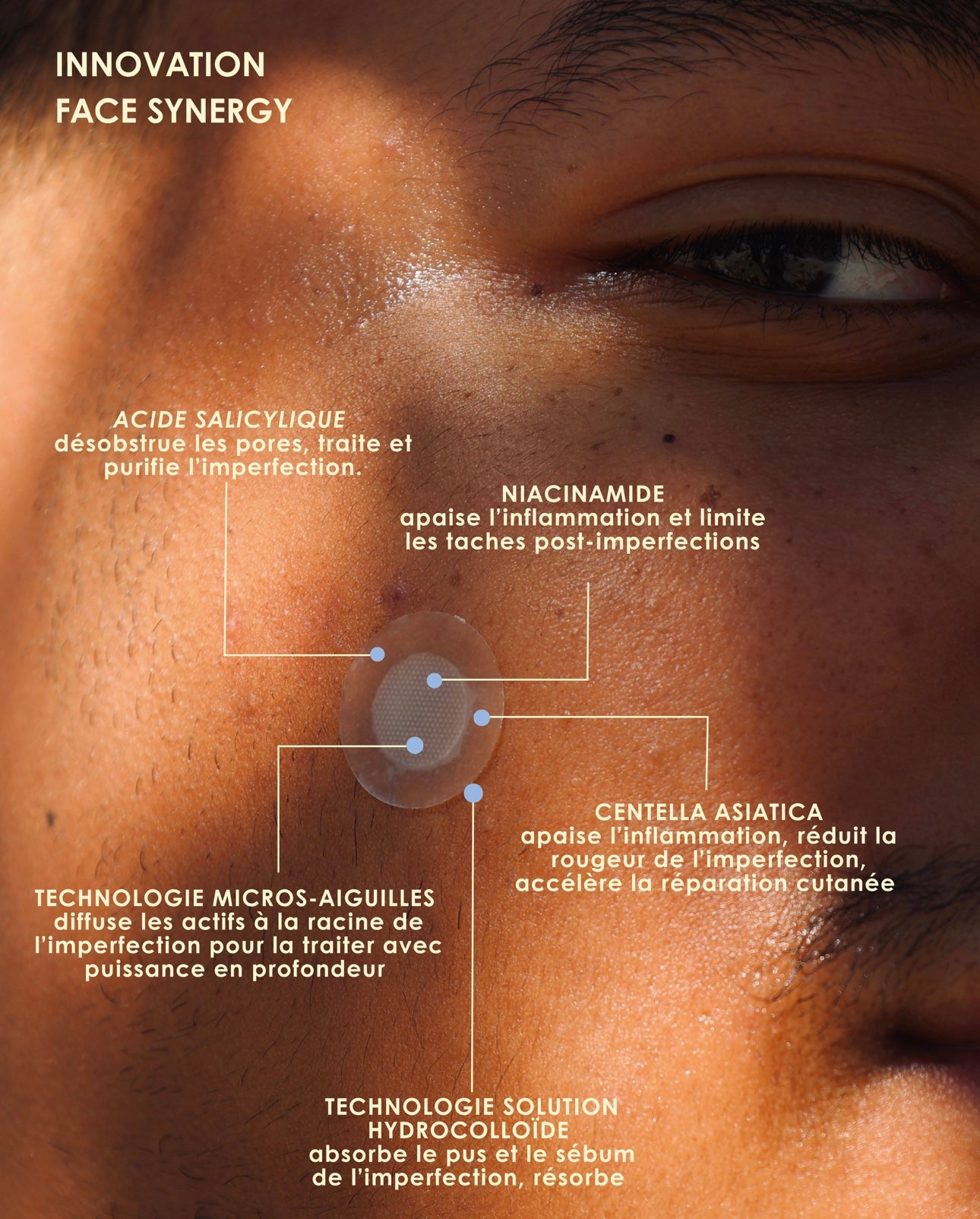 BYE BUTTER PATCHS •18 patchs micros-aiguilles