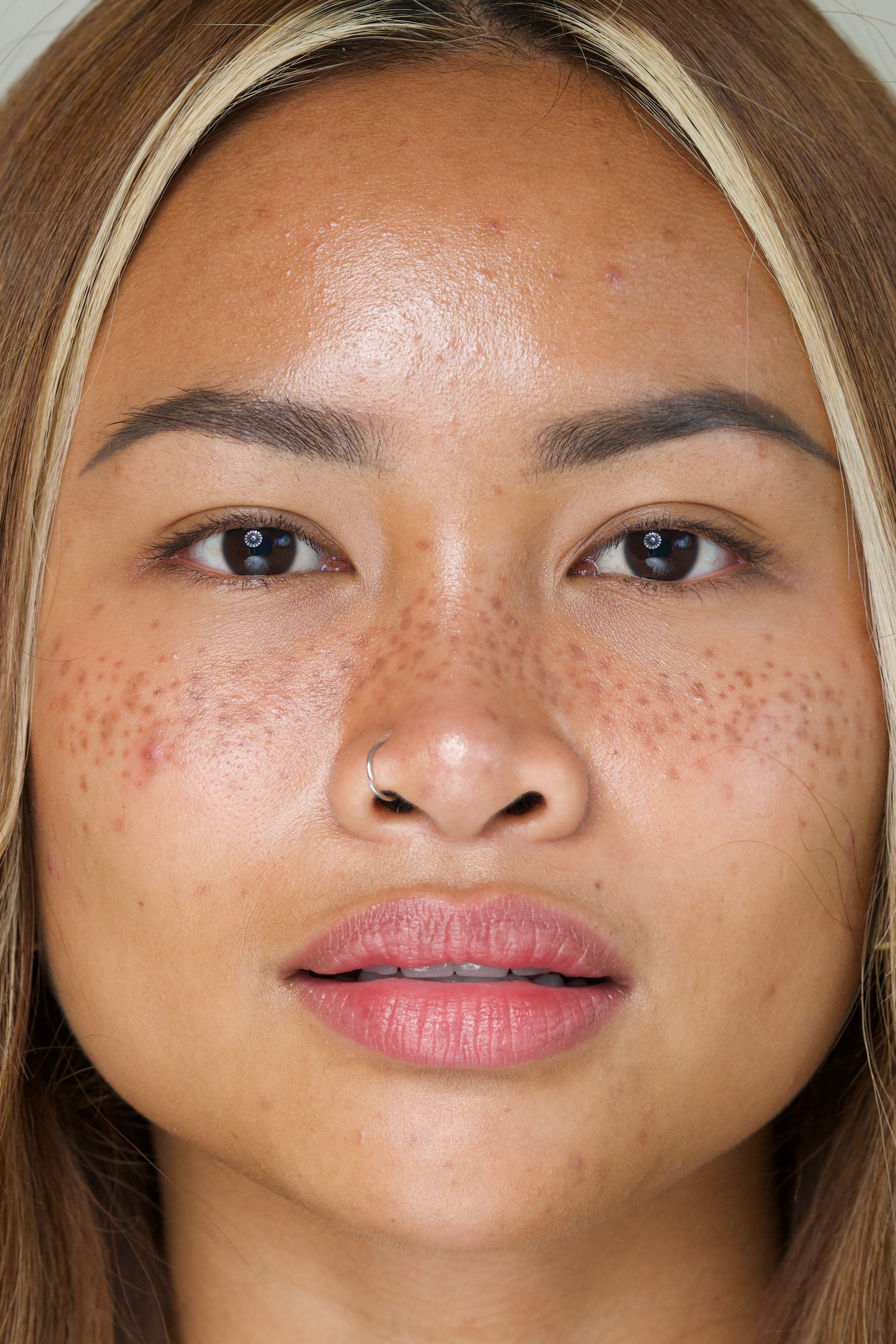 SET ANTI-IMPERFECTIONS